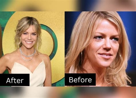 kaitlin olsen plastic surgery|Like a Boss — Kaitlin Olson’s Response to Plastic。